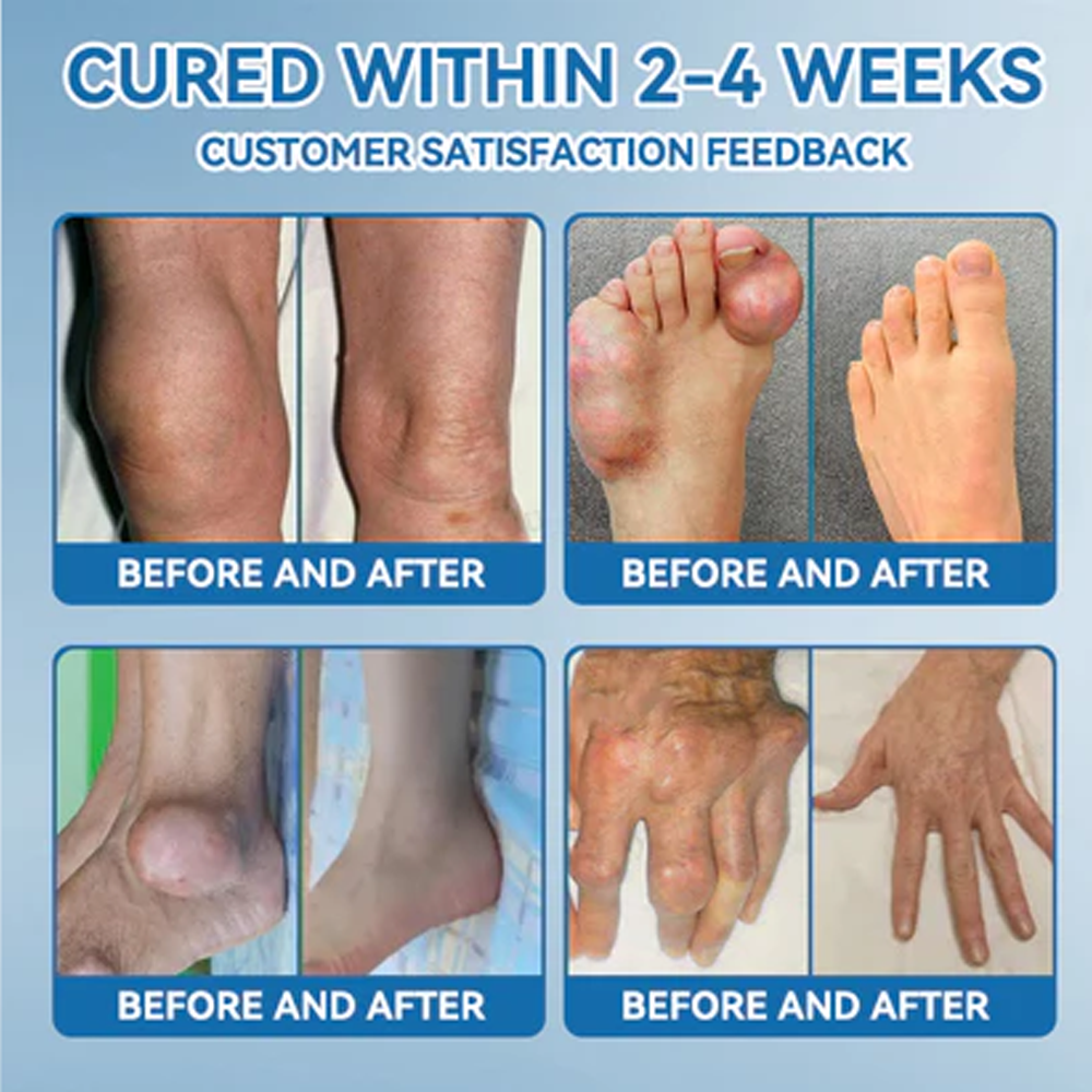 LBMLBM™ BPC-157 Joint Healing Cream 👨⚕️ FDA Certified (Targets arthritis, nerve pain, rheumatism & sports-related stiffness for better mobility)