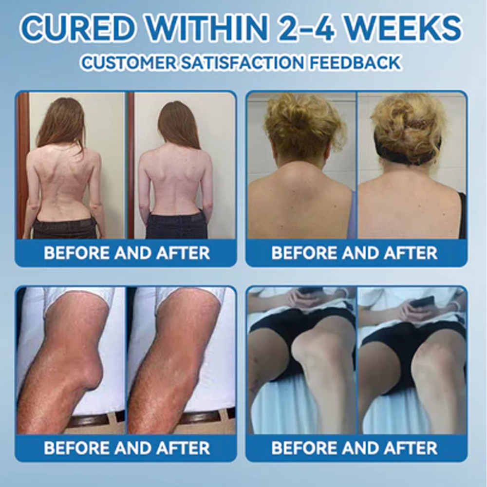 LBMLBM™ BPC-157 Joint Healing Cream 👨‍⚕️ FDA Certified (Targets arthritis, nerve pain, rheumatism & sports-related stiffness for better mobility)