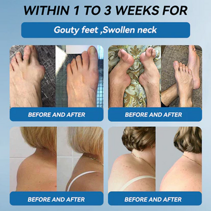 LBMLBM™ BPC-157 Joint Healing Cream 👨‍⚕️ FDA Certified (Targets arthritis, nerve pain, rheumatism & sports-related stiffness for better mobility)