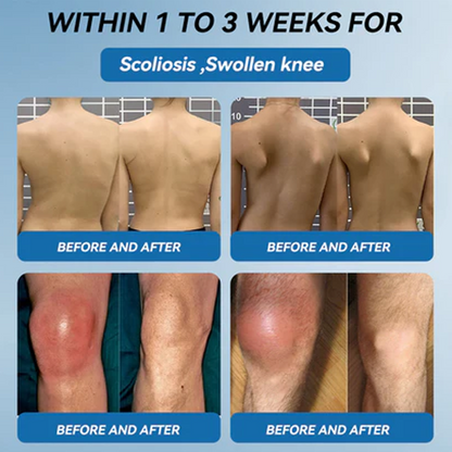 LBMLBM™ BPC-157 Joint Healing Cream 👨‍⚕️ FDA Certified (Targets arthritis, nerve pain, rheumatism & sports-related stiffness for better mobility)