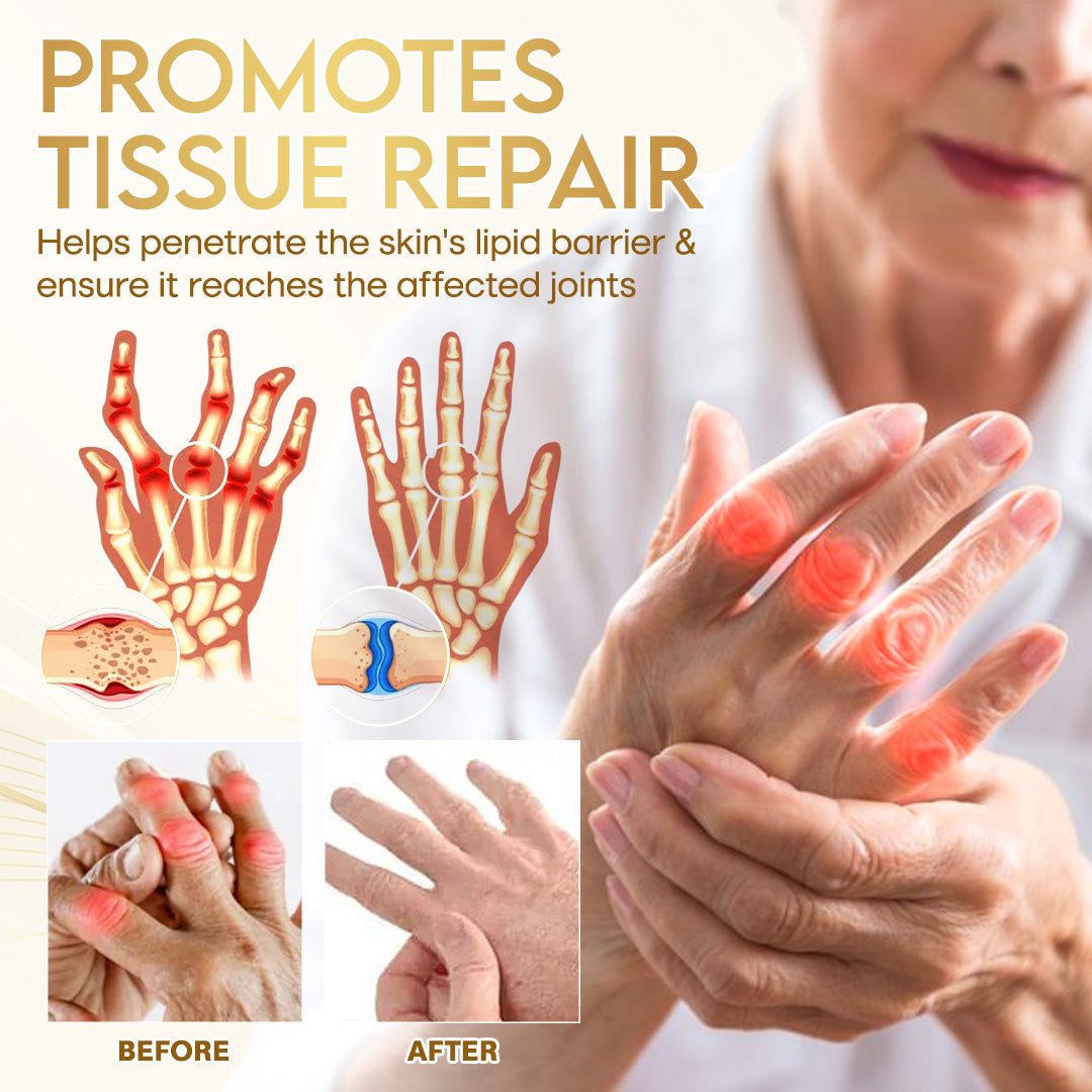 Comfort for Joints ⚡ | Odeiun™ Orthopedic Cream • Bee Venom + Botulinum • AAOS-Inspired