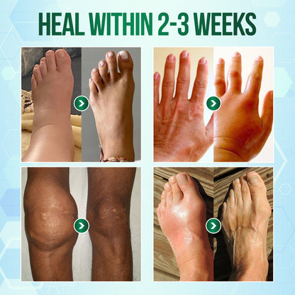 🔥Last Day 75% OFF--[Official Store] Negusy™ Rapid Nerve Relief Cream