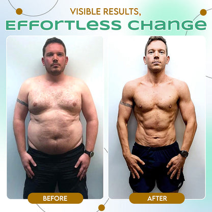 LBMLBM™ NIDDK-Tirzepatide Slimming NANO MICRONEEDLE PATCH 👨‍⚕️（Zero Pain, 24/7 Release | Lose 20lbs FAST | 90% Sugar Drop | ）