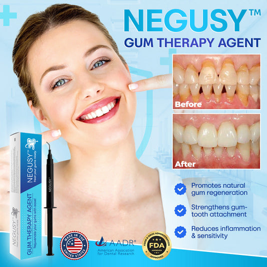 🔥🔥🔥Last Day 75% OFF--🦷 Negusy™ Gum Therapy Agent