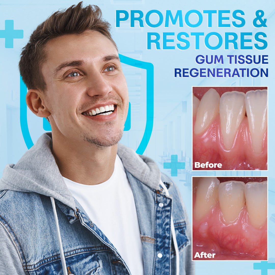 🔥🔥🔥Last Day 75% OFF--🦷 Negusy™ Gum Therapy Agent