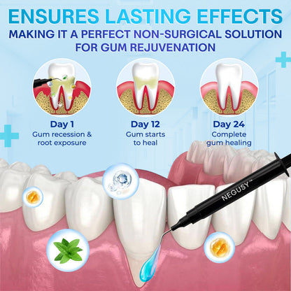 🔥🔥🔥Last Day 75% OFF--🦷 Negusy™ Gum Therapy Agent