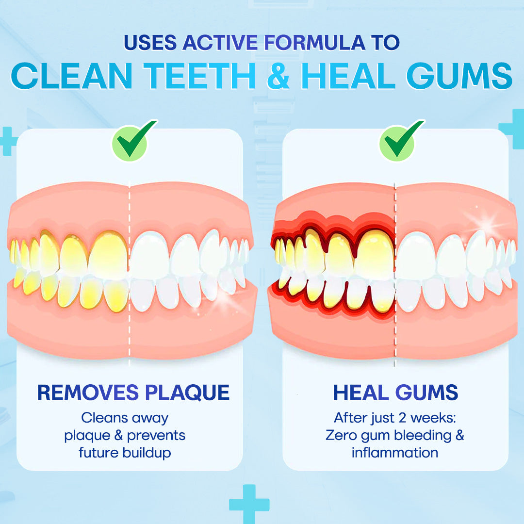 🔥🔥🔥Last Day 75% OFF--🦷 Negusy™ Gum Therapy Agent