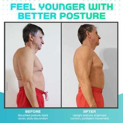 Seurico™ Premium Posture Corrector – Straighten Your Spine & Relieve Pain Instantly✨