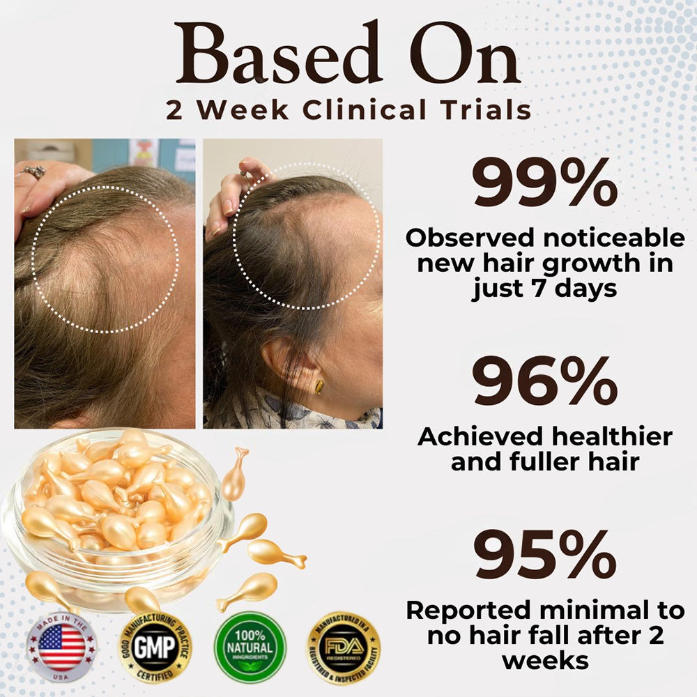 Odeiun™ Hair Renewal Capsules – Clinically Proven Formula for Thicker, Fuller, Healthier Hair in Weeks