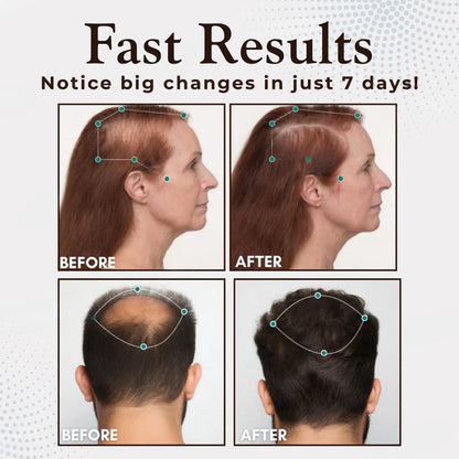 Odeiun™ Hair Renewal Capsules – Clinically Proven Formula for Thicker, Fuller, Healthier Hair in Weeks