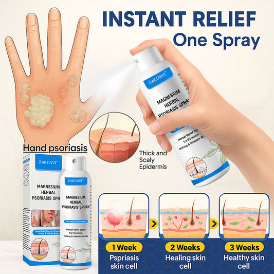 ✅ Zakdavi™ Magnesium Herbal Psoriasis Spray – FDA Certified Relief for Psoriasis, Eczema & Skin Tags