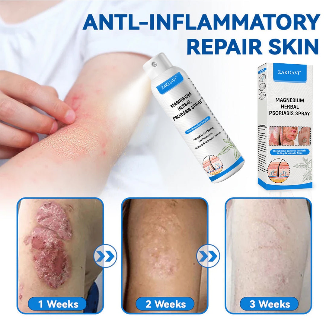 ✅ Zakdavi™ Magnesium Herbal Psoriasis Spray – FDA Certified Relief for Psoriasis, Eczema & Skin Tags
