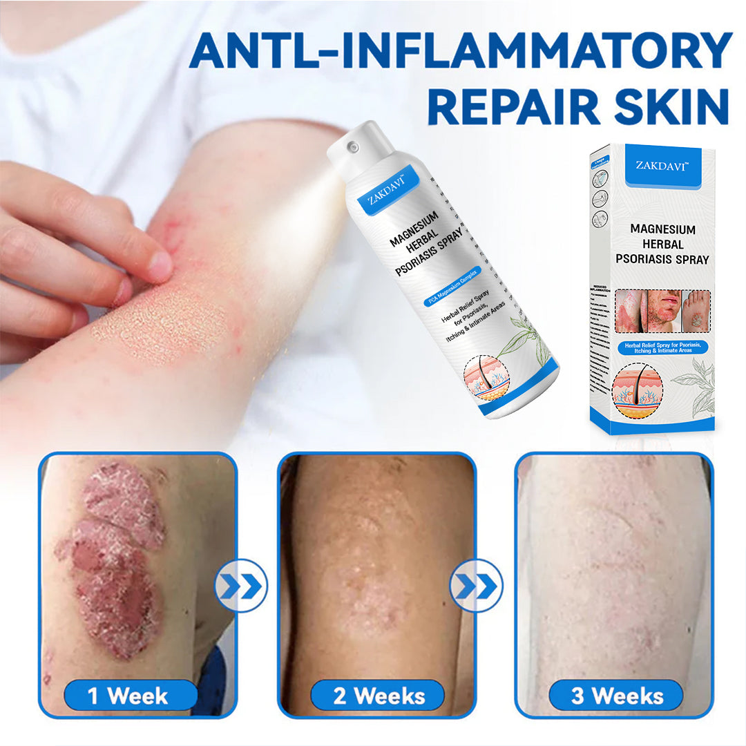✅ Zakdavi™ Magnesium Herbal Psoriasis Spray – FDA Certified Relief for Psoriasis, Eczema & Skin Tags